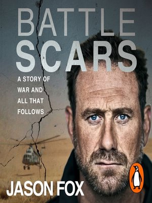 Battle Scars - Audiobook